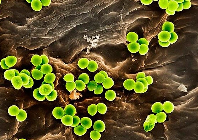 Ґрунтові мікроорганізми при вирощуванні марихуани 